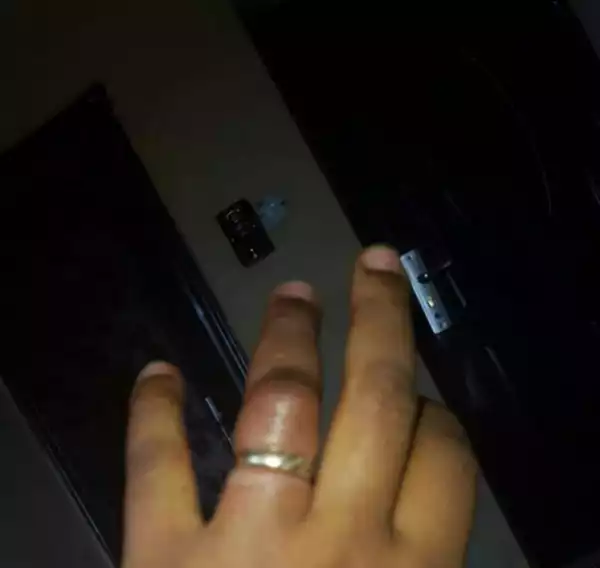 DISHEARTENING! Married Woman’s Finger Set To Be Cut Off, As Her Wedding Ring Refuses To Leave [Photos]